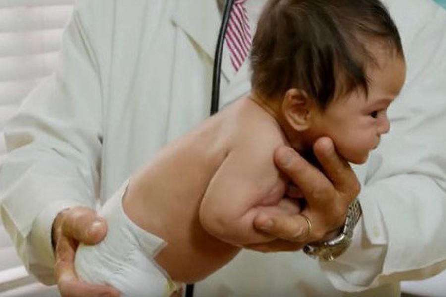 Calmar a nuestro bebé cuando llora. El Doctor Richard Hamilton nos lo muestra en este video